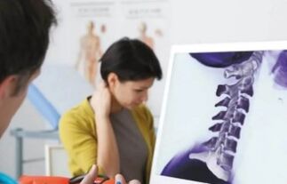 Behandlung der zervikalen Osteochondose