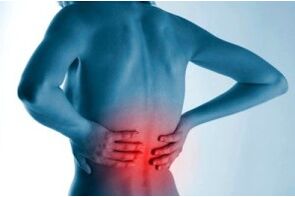 Lokalisation einer spinalen Osteochondrose